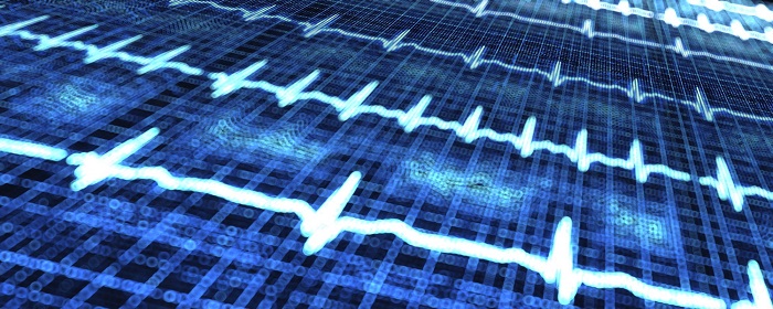Blue heartbeat line